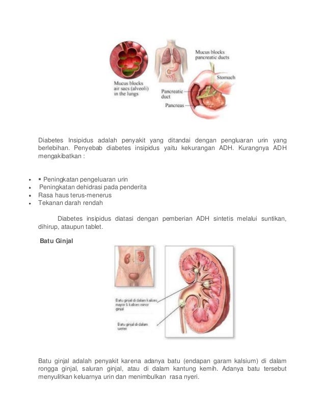 86 Gambar Ginjal Pada Penderita Diabetes Insipidus Paling Bagus Gambar Pixabay