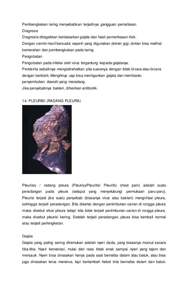 Kelainan dan penyakit pada sistem pernapasan manusia Kelainan dan penyakit pada sistem pernapasan manusia