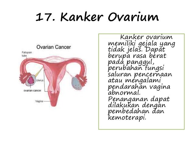 Kelainan dan penyakit pada sistem reproduksi