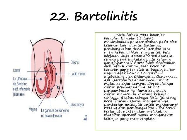 Kelainan Penyakit Sistem Reproduksi 24 23 Gambar Sketsa Dokter Wanita