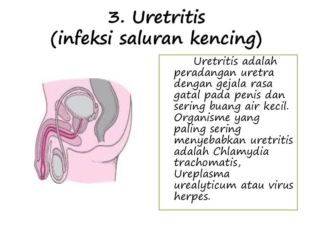 Kelainan dan penyakit pada sistem reproduksi