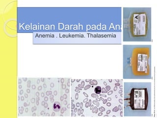 Kelainan Darah pada Anak
Anemia . Leukemia. Thalasemia
 