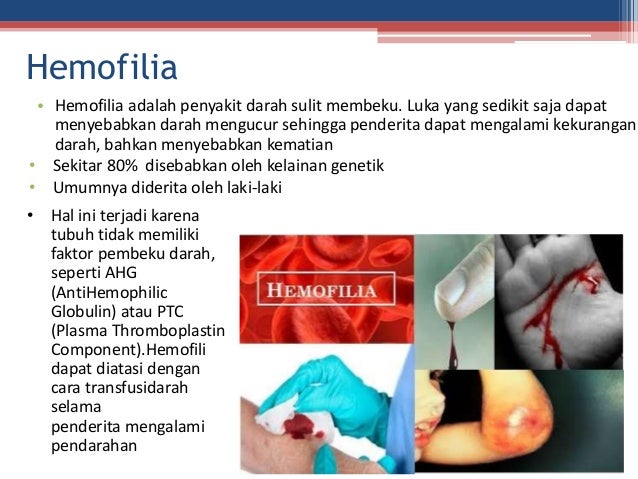 Darah sukar membeku diakibatkan oleh kurangnya