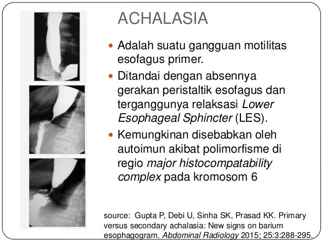 ACHALASIA ADALAH PDF