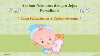 Asuhan Neonatus dengan Jejas
Persalinan
* CaputSuccadeneum & Cephalhematoma *
3/9/2020 1
 