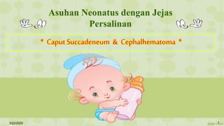 Asuhan Neonatus dengan Jejas
Persalinan
* CaputSuccadeneum & Cephalhematoma *
3/22/2020 1
 