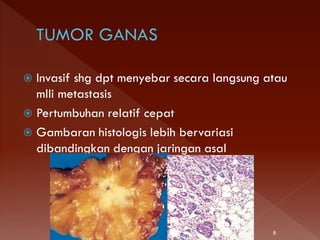  Invasif shg dpt menyebar secara langsung atau
mlli metastasis
 Pertumbuhan relatif cepat
 Gambaran histologis lebih bervariasi
dibandingkan dengan jaringan asal
8
 
