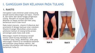 Kaki Rakhitis KELAINAN_PADA_OTOT_DAN_TULANG_ppt.pptx