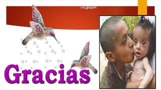 desnutricion infantil