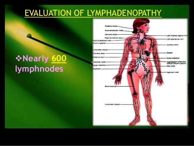 Kelenjar Getah Bening