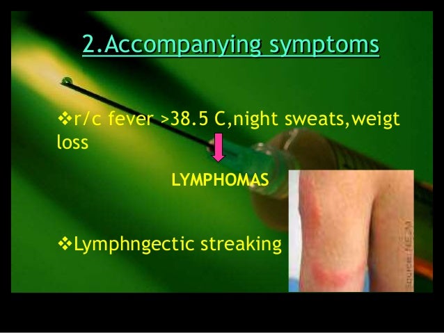 Kelenjar Getah Bening