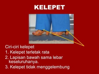 KELEPET
Ciri-ciri kelepet
1. Kelepet terletak rata
2. Lapisan bawah sama lebar
keseluruhanya.
3. Kelepet tidak menggelembung
 