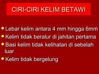 CIRI-CIRI KELIM BETAWICIRI-CIRI KELIM BETAWI
Lebar kelim antara 4 mm hingga 6mmLebar kelim antara 4 mm hingga 6mm
Kelim tidak beralur di jahitan pertamaKelim tidak beralur di jahitan pertama
Basi kelim tidak kelihatan di sebelahBasi kelim tidak kelihatan di sebelah
luarluar
Kelim tidak bergelungKelim tidak bergelung
 