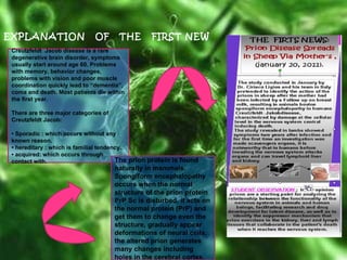 EXPLANATION  OF  THE  FIRST NEW Creutzfeldt  Jacob disease is a rare degenerative brain disorder, symptoms usually start around age 60. Problems with memory, behavior changes, problems with vision and poor muscle coordination quickly lead to “dementia”, coma and death. Most patients die within the first year. There are three major categories of  Creutzfeldt Jacob: • Sporadic : which occurs without any known reason. • hereditary : which is familial tendency. • acquired: which occurs through contact with. The prion protein is found naturally in mammals. Spongiform encephalopathy occurs when the normal structure of the prion protein PrP Sc is disturbed, it acts on the normal protein (PrP) and get them to change even the structure, gradually appear deformations of neural cells, the altered prion generates many changes including holes in the cerebral cortex. 