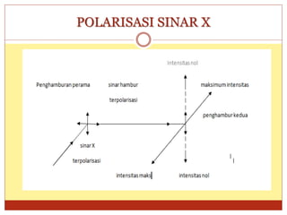 POLARISASI SINAR X
 