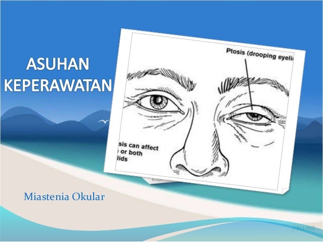 Kelompok 1 (miastenia gravis)