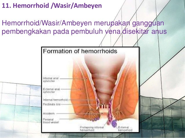 Gangguan Sistem Pencernaan