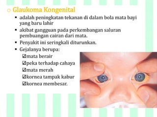 o Glaukoma Kongenital
 adalah peningkatan tekanan di dalam bola mata bayi
yang baru lahir
 akibat gangguan pada perkembangan saluran
pembuangan cairan dari mata.
 Penyakit ini seringkali diturunkan.
 Gejalanya berupa:
mata berair
peka terhadap cahaya
mata merah
kornea tampak kabur
kornea membesar.
 