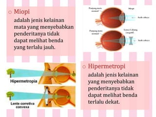 o Miopi
adalah jenis kelainan
mata yang menyebabkan
penderitanya tidak
dapat melihat benda
yang terlalu jauh.
o Hipermetropi
adalah jenis kelainan
yang menyebabkan
penderitanya tidak
dapat melihat benda
terlalu dekat.
 