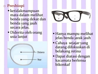 o Presbiopi
 ketidakmampuan
mata dalam melihat
benda yang dekat dan
benda yang jauh
secara jelas.
 Diderita oleh orang
usia lanjut
 Hanya mampu melihat
jelas benda jarak jauh
 Cahaya sejajar yang
datang difokuskan di
belakang retina
 Dapat diatasi dengan
kacamata berlensa
bikonkaf
 