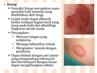 o Kurap
 Penyakit Kurap merupakan suatu
penyakit kulit menular yang
disebabkan oleh fungi.
 Gejala mulai dapat dikenali
ketika terdapat bagian kecil yang
kasar pada kulit dan dikelilingi
lingkaran merah muda.
 Pencegahan :
• Mencuci tangan yang
sempurna.
• Menjaga kebersihan tubuh.
• Mengindari kontak dengan
penderita.
 Dapat diobati dengan anti jamur
yang mengandung mikonazol
dan kloritomazol dengan benar
dapat menghilangkan infeksi.
 