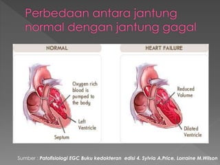 Sumber : Patofisiologi EGC Buku kedokteran edisi 4. Sylvia A.Price, Lorraine M.Wilson
 