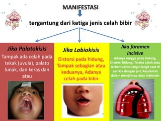 MANIFESTASI 
tergantung dari ketiga jenis celah bibir 
Jika Palatokisis 
Tampak ada celah pada 
tekak (uvula), palato 
lunak, dan keras dan 
atau 
Jika Labiokisis 
Distorsi pada hidung, 
Tampak sebagian atau 
keduanya, Adanya 
celah pada bibir 
Jika foramen 
incisive 
Adanya rongga pada hidung, 
Distorsi hidung, Teraba celah atau 
terbentuknya langit-langit saat di 
periksa dengan jari, Kesukaran 
dalam menghisap atau makanan 
 
