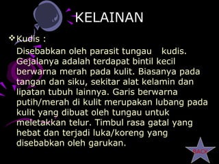 KELAINAN
 Kudis :
  Disebabkan oleh parasit tungau kudis.
  Gejalanya adalah terdapat bintil kecil
  berwarna merah pada kulit. Biasanya pada
  tangan dan siku, sekitar alat kelamin dan
  lipatan tubuh lainnya. Garis berwarna
  putih/merah di kulit merupakan lubang pada
  kulit yang dibuat oleh tungau untuk
  meletakkan telur. Timbul rasa gatal yang
  hebat dan terjadi luka/koreng yang
  disebabkan oleh garukan.
                                        BACK
 