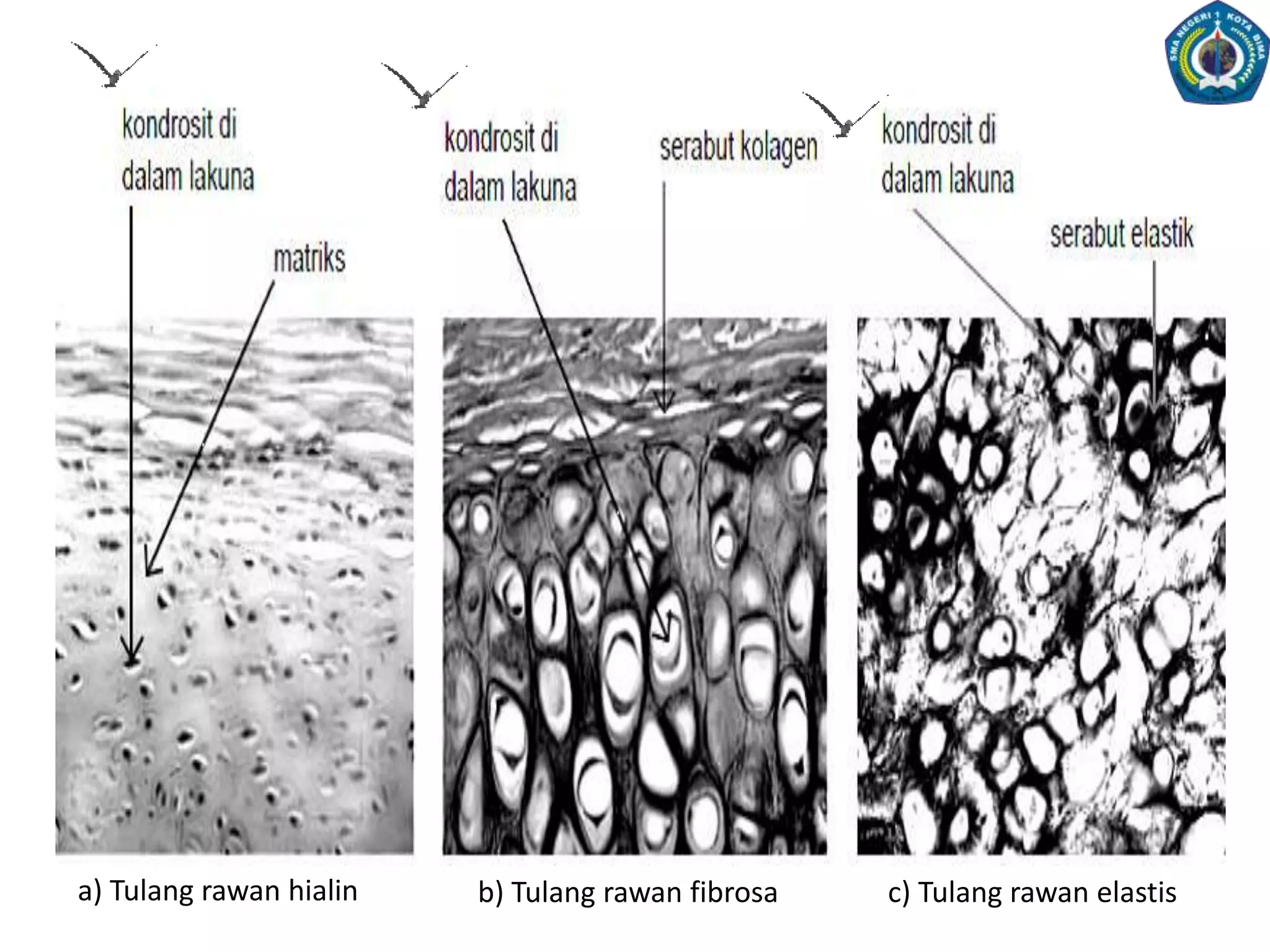 Tempatmelekatnyaotot-ototrangka