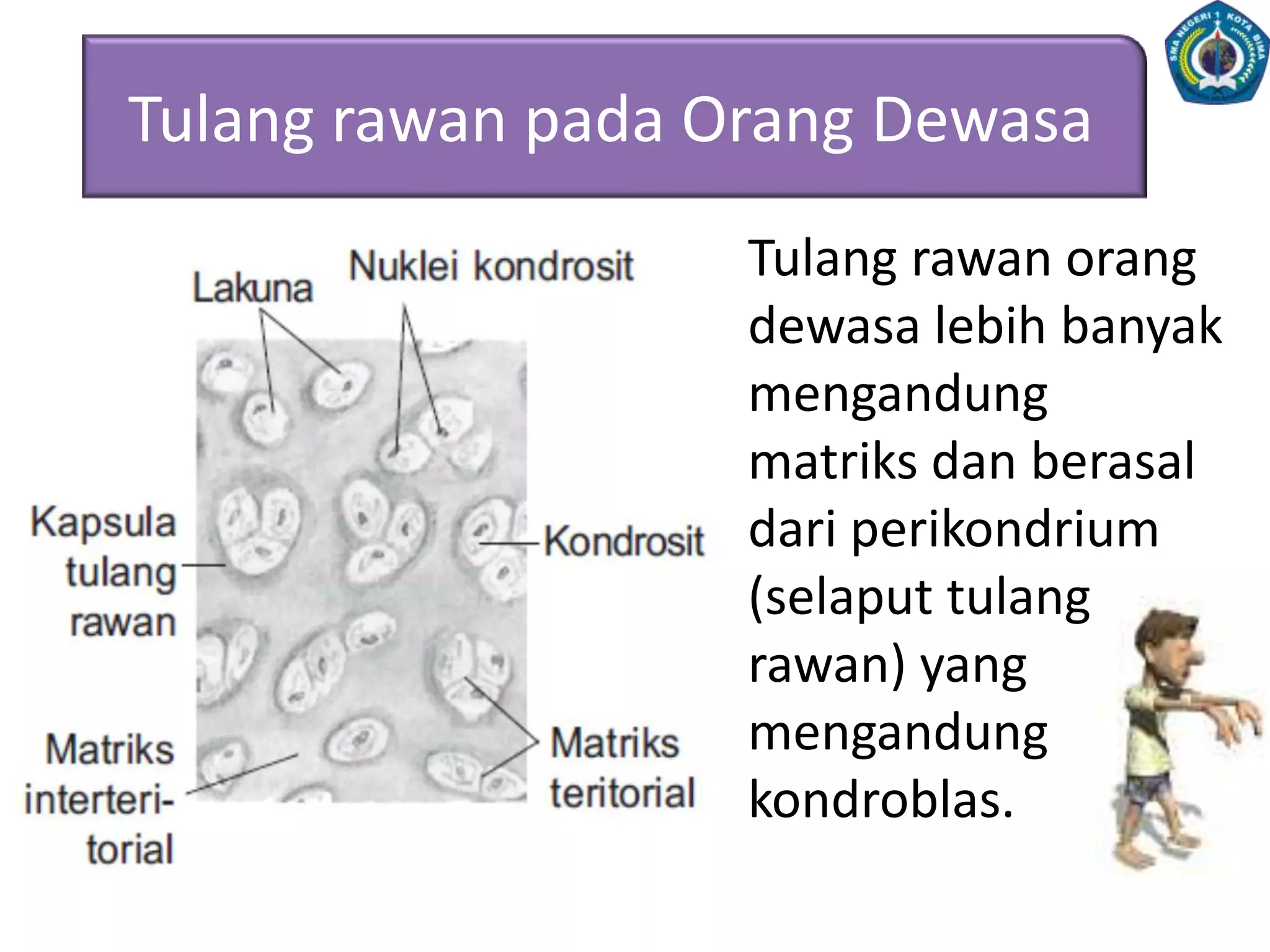 2.A. Jenis TulangBerdasarkanmatrikspenyusunnya, tulangdibedakanmenjadidua,yaitu:TulangRawan (Kartilago)TulangKeras (Osteon)