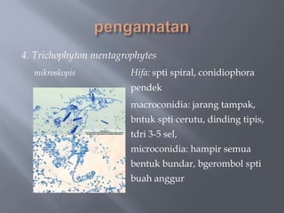 4. Trichophyton mentagrophytes
  mikroskopis           Hifa: spti spiral, conidiophora
                        pendek
                        macroconidia: jarang tampak,
                        bntuk spti cerutu, dinding tipis,
                        tdri 3-5 sel,
                        microconidia: hampir semua
                        bentuk bundar, bgerombol spti
                        buah anggur
 