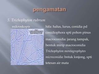 5. Trichophyton rubrum
  mikroskopis            hifa: halus, lurus, conidia pd
                         conidiophora spti pohon pinus

                         macroconidia: jarang tampak,
                         bentuk mirip macroconidia
                         Trichophyton mentagrophytes
                         microconidia: bntuk lonjong, spti
                         tetesan air mata
 