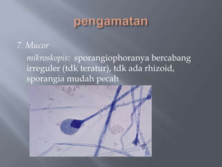 7. Mucor
   mikroskopis: sporangiophoranya bercabang
   irreguler (tdk teratur), tdk ada rhizoid,
   sporangia mudah pecah
 