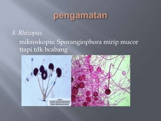 8. Rhizopus
   mikroskopis: Sporangiophora mirip mucor
   ttapi tdk bcabang
 