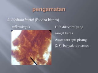 9. Piedraia hortai (Piedra hitam)
  mikroskopis                 Hifa dikotomi yang
                              sangat keras

                              Ascospora spti pisang
                              (2-8), banyak tdpt ascos
 