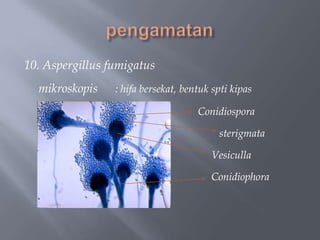 10. Aspergillus fumigatus
  mikroskopis    : hifa bersekat, bentuk spti kipas

                                     Conidiospora

                                          sterigmata

                                        Vesiculla

                                        Conidiophora
 