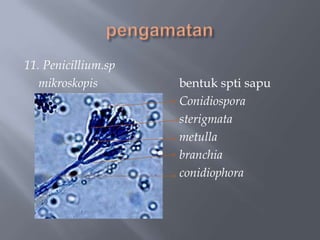 11. Penicillium.sp
   mikroskopis       bentuk spti sapu
                     Conidiospora
                     sterigmata
                     metulla
                     branchia
                     conidiophora
 