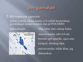 2. Microsporum gypseum
  koloni: warna coklat muda s/d coklat kemerahan,
  permukaan mula2 lembek dan jd POUDERY
  mikroskopis           hifa: lebar dan cukup halus
                        macroconidia: tdri 4-6 sel,
                        bentuk spti spindle, ujun atas
                        tumpul, dinding tipis
                        microconidia: tidak khas, jrg
                        ditemukan
 
