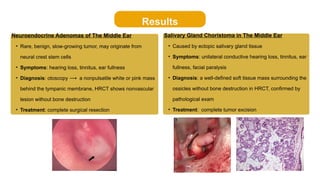Diagnosis and Management of Unexplained Conductive Hearing Loss with ...