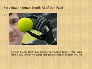 Tangan bionik aktif tidak sekedar mengganti fungsi tetapi juga 
lebih kuat, tangan ini dapat mengangkat beban seberat 100 kg 
 