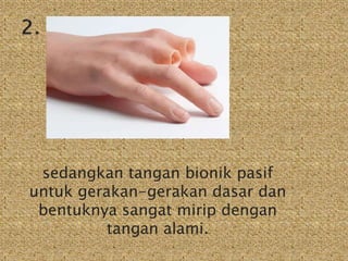 sedangkan tangan bionik pasif 
untuk gerakan-gerakan dasar dan 
bentuknya sangat mirip dengan 
tangan alami. 
 