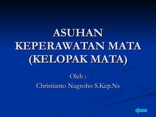 ASUHAN KEPERAWATAN MATA (KELOPAK MATA) Oleh : Christianto Nugroho S.Kep.Ns 