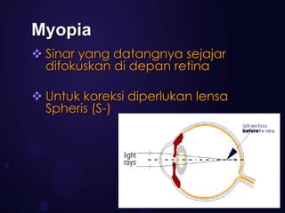 Myopia
 Sinar yang datangnya sejajar
  difokuskan di depan retina

 Untuk koreksi diperlukan lensa
  Spheris (S-)
 