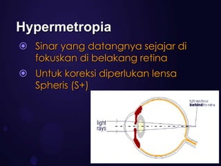 Hypermetropia
 Sinar yang datangnya sejajar di
  fokuskan di belakang retina
 Untuk koreksi diperlukan lensa
  Spheris (S+)
 