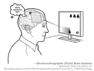 ~ Electrocorticographic (ECoG) Brain Implants Wadsworth Center Lab Albany, NY http://www.nytimes.com/2011/09/18/magazine/the-cyborg-in-us-all.html?_r=1&ref=technology 