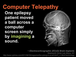 Computer Telepathy One epilepsy  patient moved  a ball across a  computer  screen simply  by  imagining  a  sound. ~ Electrocorticographic (ECoG) Brain Implants Wadsworth Center Lab Albany, NY http://www.nytimes.com/2011/09/18/magazine/the-cyborg-in-us-all.html?_r=1&ref=technology 