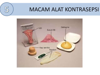 MACAM ALAT KONTRASEPSI
 