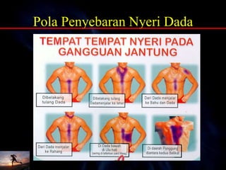 Pola Penyebaran Nyeri Dada
 