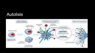 Autolisis