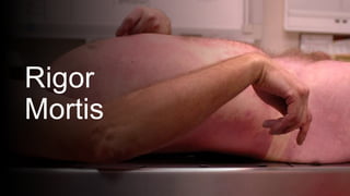 Rigor
Mortis